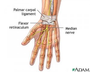 Carpel Tunnel Syndrome and Acupuncture