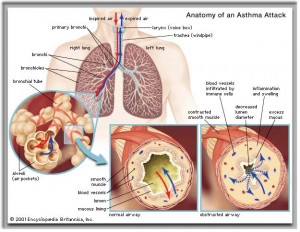 Acupuncture and Asthma