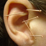 Ear Acupuncture Hawaii